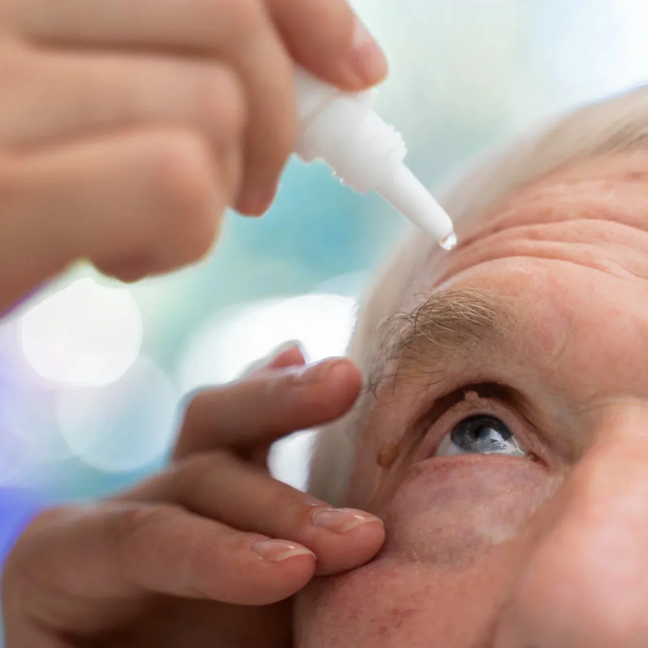 Glaucoma: Mechanisms, Pathophysiology, and Therapeutic Approaches