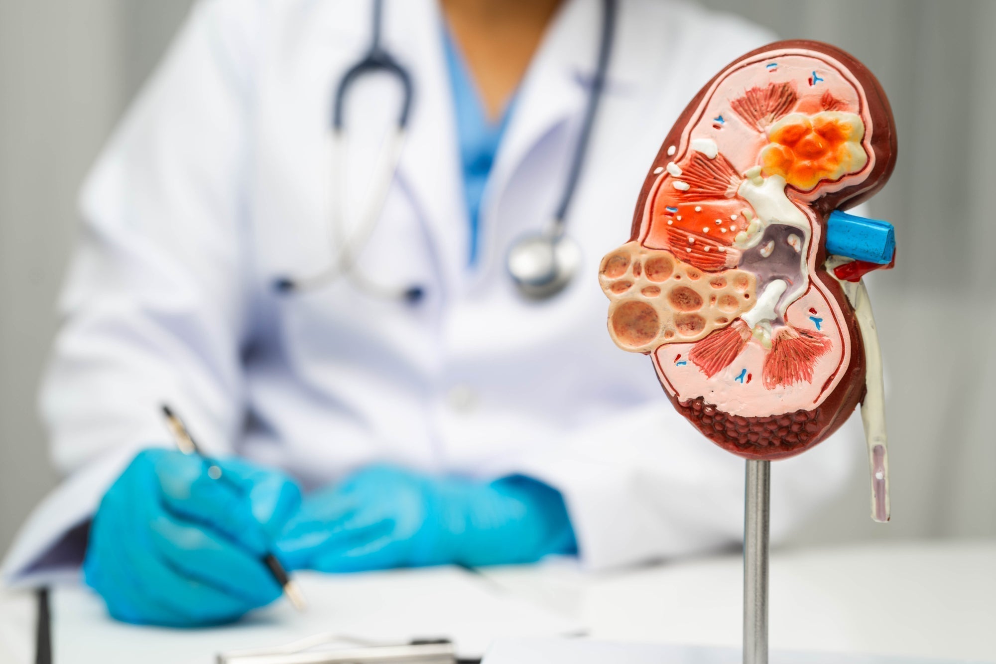 Milk Thistle and Kidneys: Best Supplement or Bust?