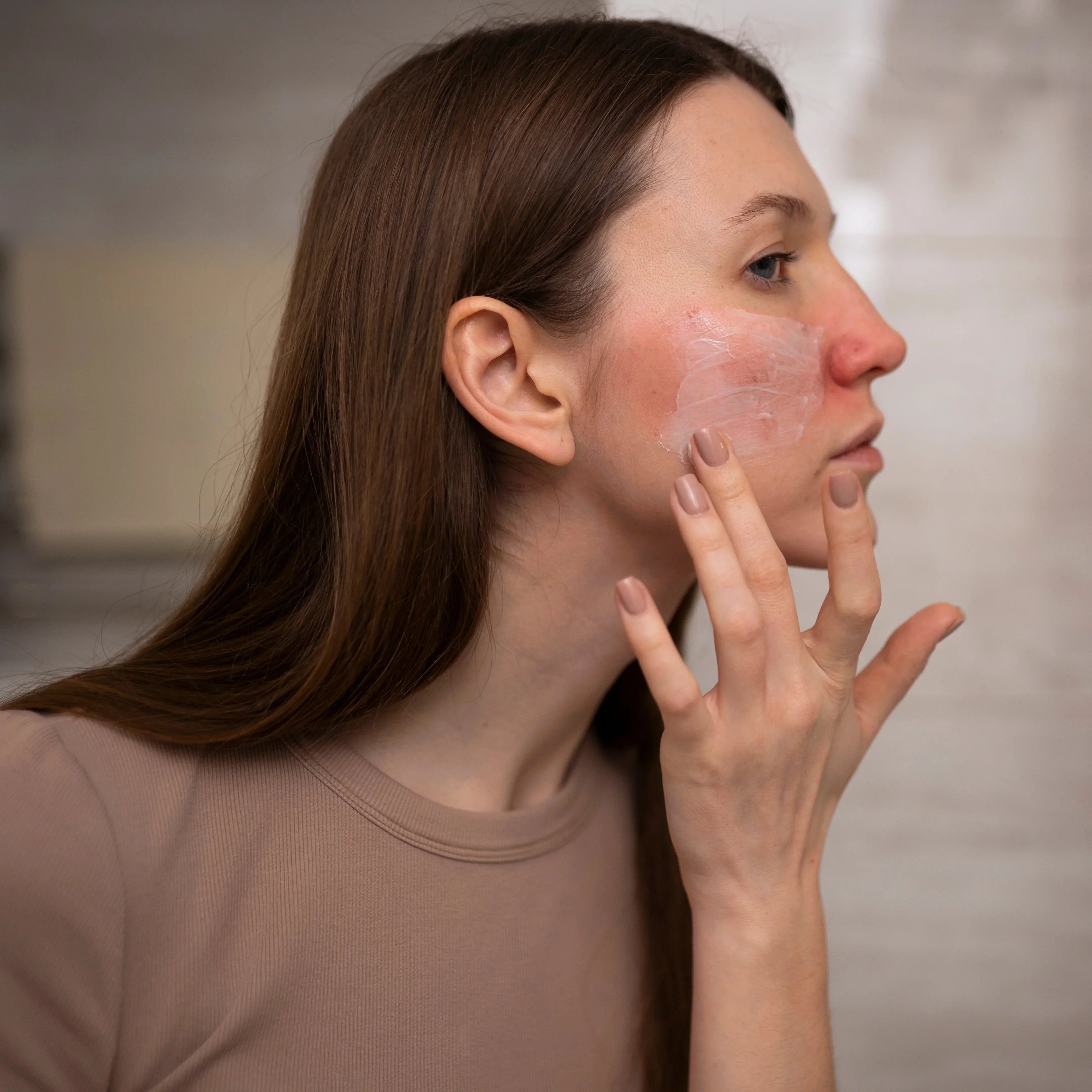 Eczema: Pathophysiology, Mechanisms, and Evidence-Based Therapeutic Approaches